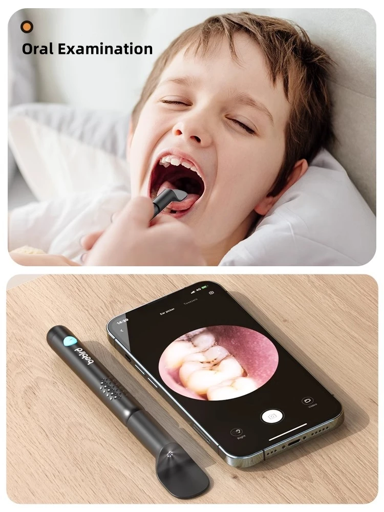 Bebird R3 Ear Cleaner Smart Vi - Pet Ear Cleaner recensione e prezzo