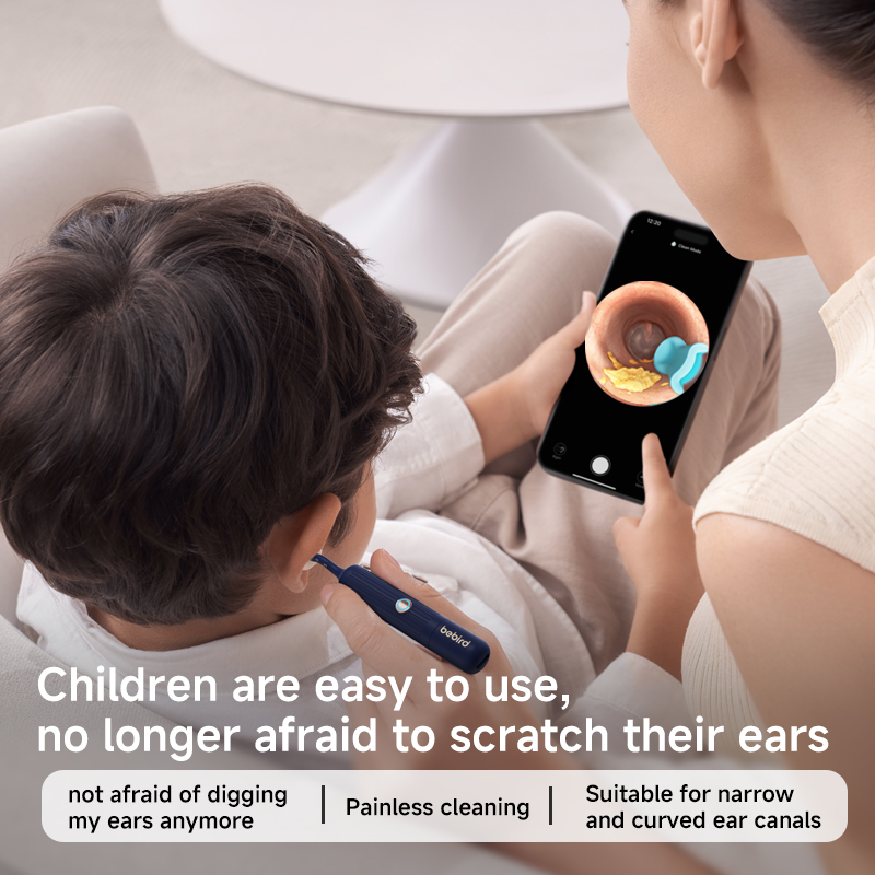 2025 Nuovo arrivo Bebird EarSi - Pet Ear Cleaner recensione e prezzo